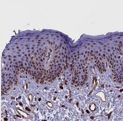NIPBL Antibody