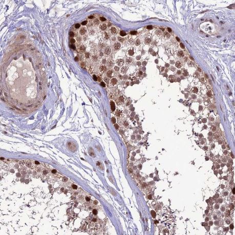 DIS3 Antibody