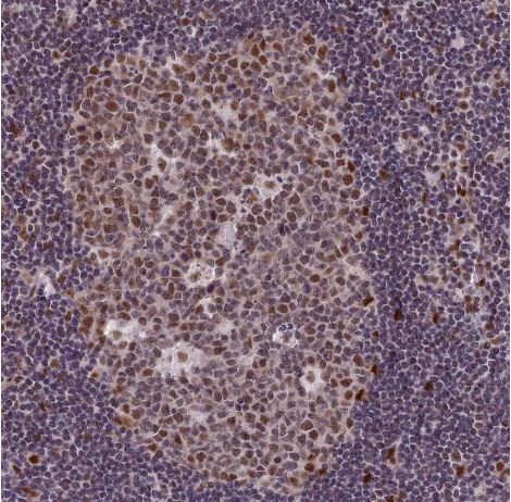 DIS3 Antibody