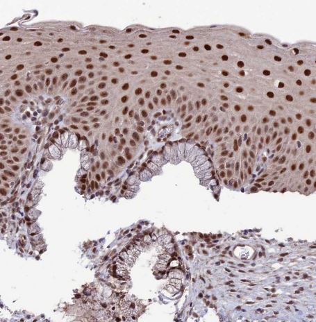 DIS3 Antibody