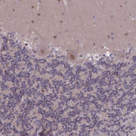 DIS3 Antibody