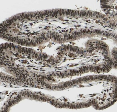 PRKRIR Antibody - BSA Free