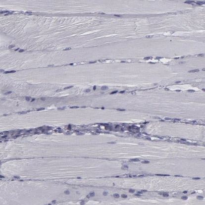 CEBP epsilon Antibody - BSA Free