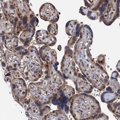 UBLCP1 Antibody