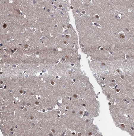 UBLCP1 Antibody