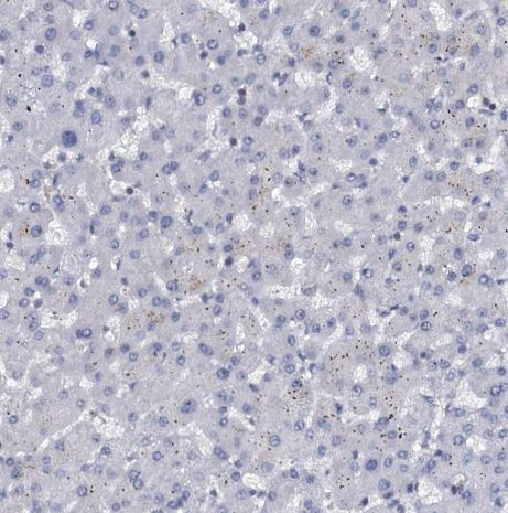 UBLCP1 Antibody