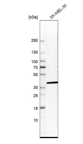 UBLCP1 Antibody