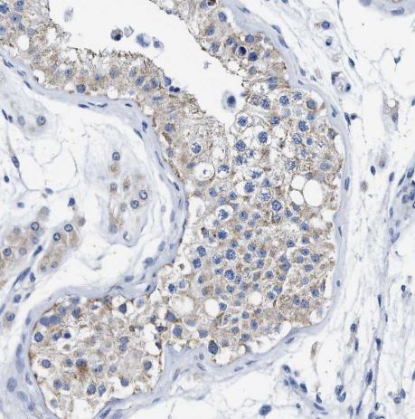 TBRG4 Antibody