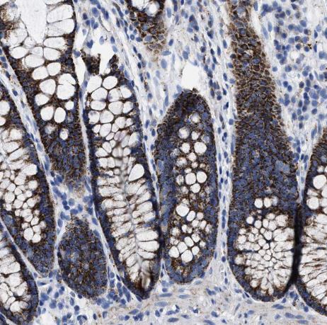 TBRG4 Antibody