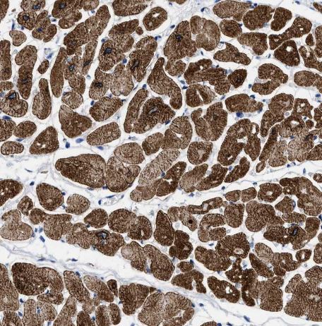 TBRG4 Antibody