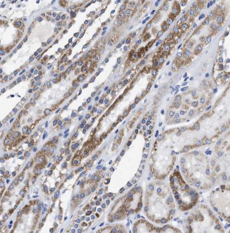 TBRG4 Antibody
