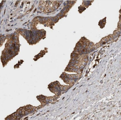 ADCK4 Antibody - BSA Free ADCK4 Antibody [NBP1-85510] -