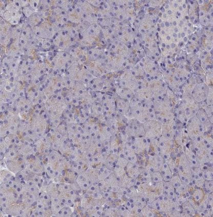 Rapsyn Antibody
