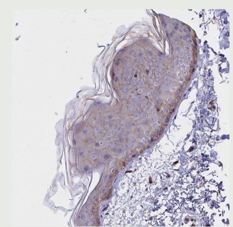 Rapsyn Antibody