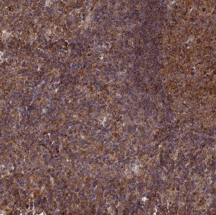 Clathrin interactor 1 Antibody