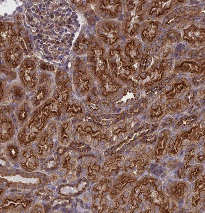 Clathrin interactor 1 Antibody