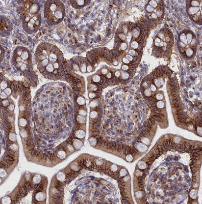 Clathrin interactor 1 Antibody