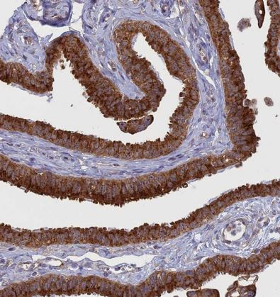 Clathrin interactor 1 Antibody
