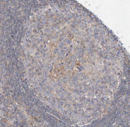 RNF7 Antibody