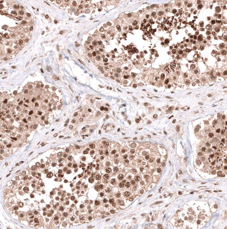 PHF20L1 Antibody