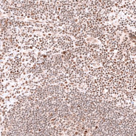 PHF20L1 Antibody