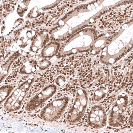 PHF20L1 Antibody