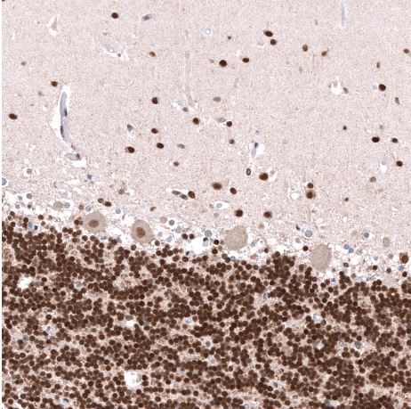 PHF20L1 Antibody