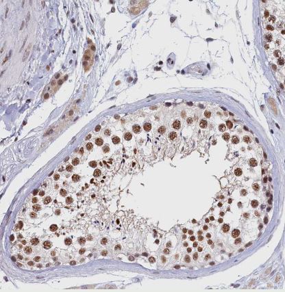 MOSPD3 Antibody
