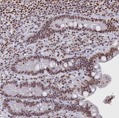 MOSPD3 Antibody