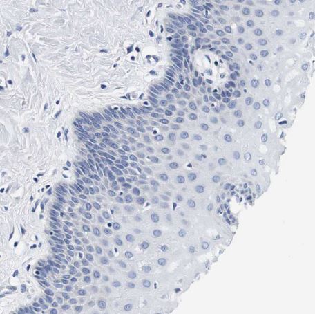 CD42b/GPIb alpha Antibody