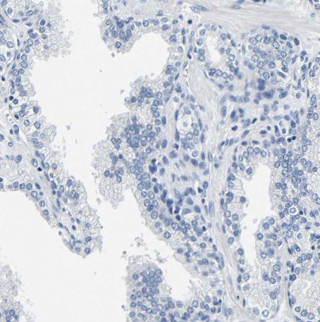 CD42b/GPIb alpha Antibody