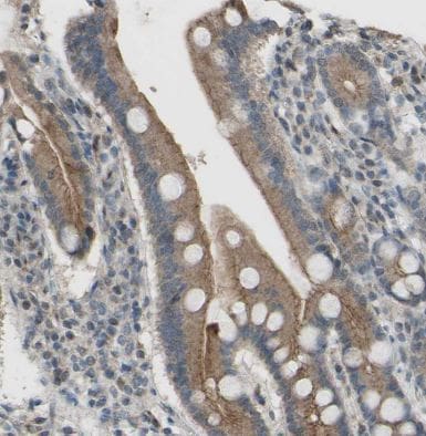 CDCP1 Antibody