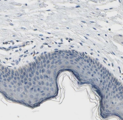 CD23/Fc epsilon RII Antibody
