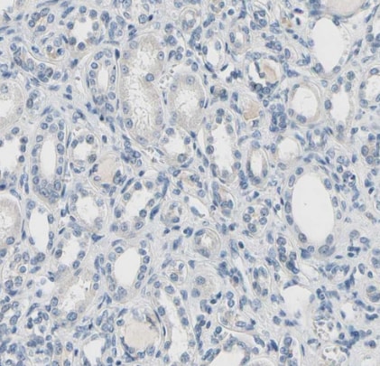 CD23/Fc epsilon RII Antibody