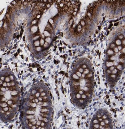 Cathepsin S Antibody