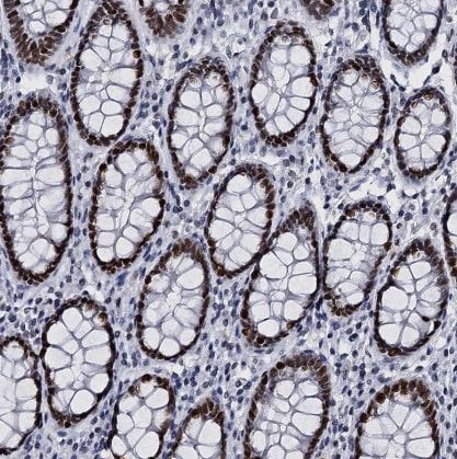 CMAS Antibody