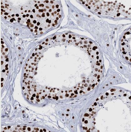 CMAS Antibody