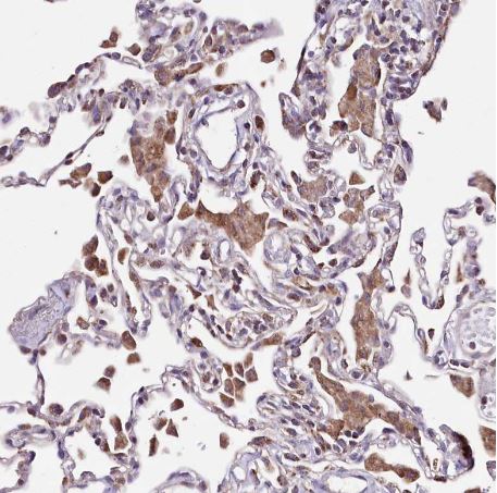 ATE1 Antibody