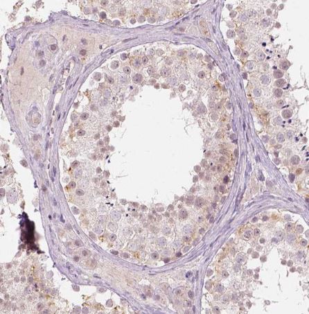 Dlx6 Antibody