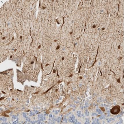 LMCD1 Antibody