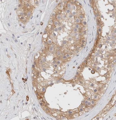 LMCD1 Antibody