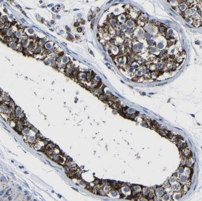 Carbonic Anhydrase VB/CA5B Antibody
