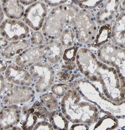 Carbonic Anhydrase VB/CA5B Antibody