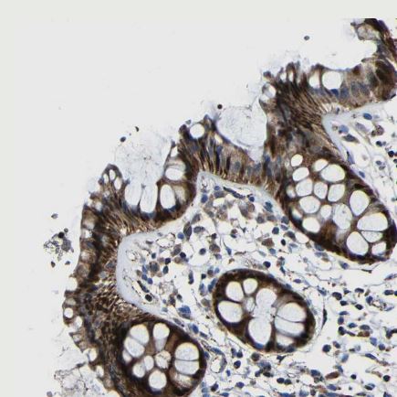 Carbonic Anhydrase VB/CA5B Antibody