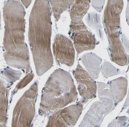 Carbonic Anhydrase VB/CA5B Antibody