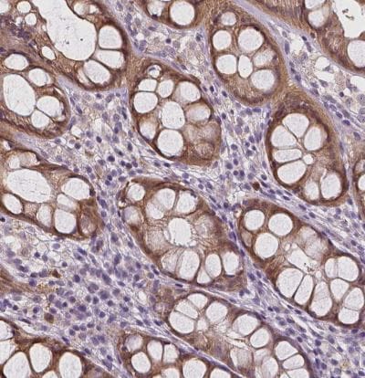 RNASE7 Antibody