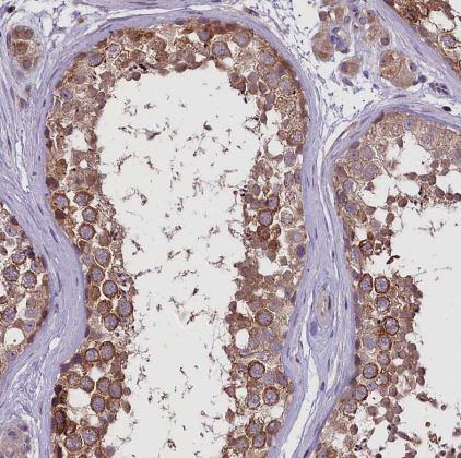 FEM1B Antibody