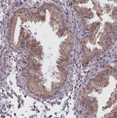 FEM1B Antibody