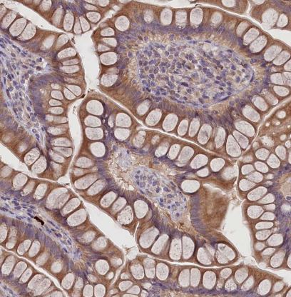 FEM1B Antibody