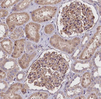 FEM1B Antibody